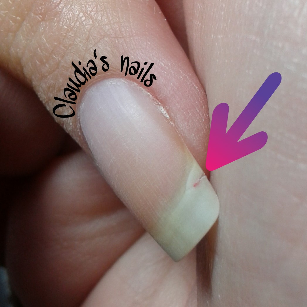 Toppe Per Riparazione Scarpe, Confezione Da 8 (4 Grandi, 4 Piccole) Black | Leroy Merlin