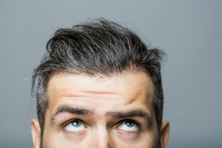 Hair Loss Finasteride Laser Light Or Minoxidil What Will