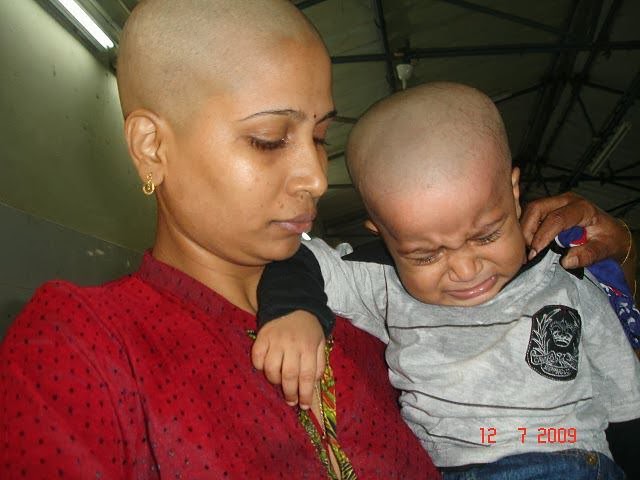 the shocking secret bald kept hidden for decades