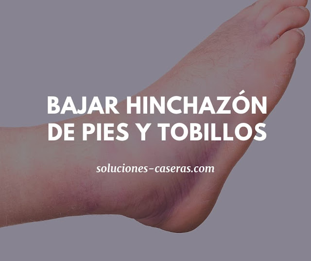 Remedios caseros para pies y tobillos hinchados