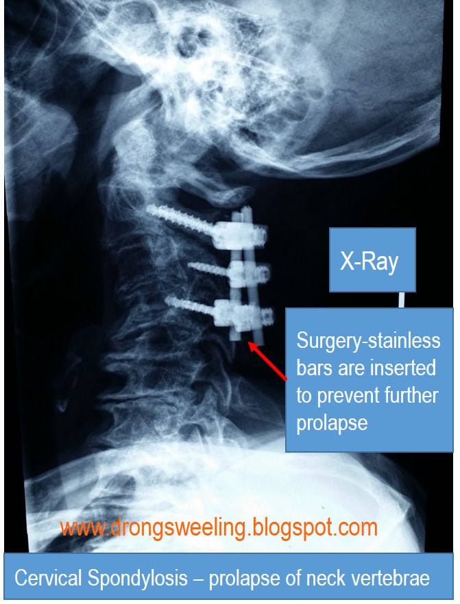 TCM News Best TCM Doctors for Neck Pain, Back Pain, Knee Pain, Trigger