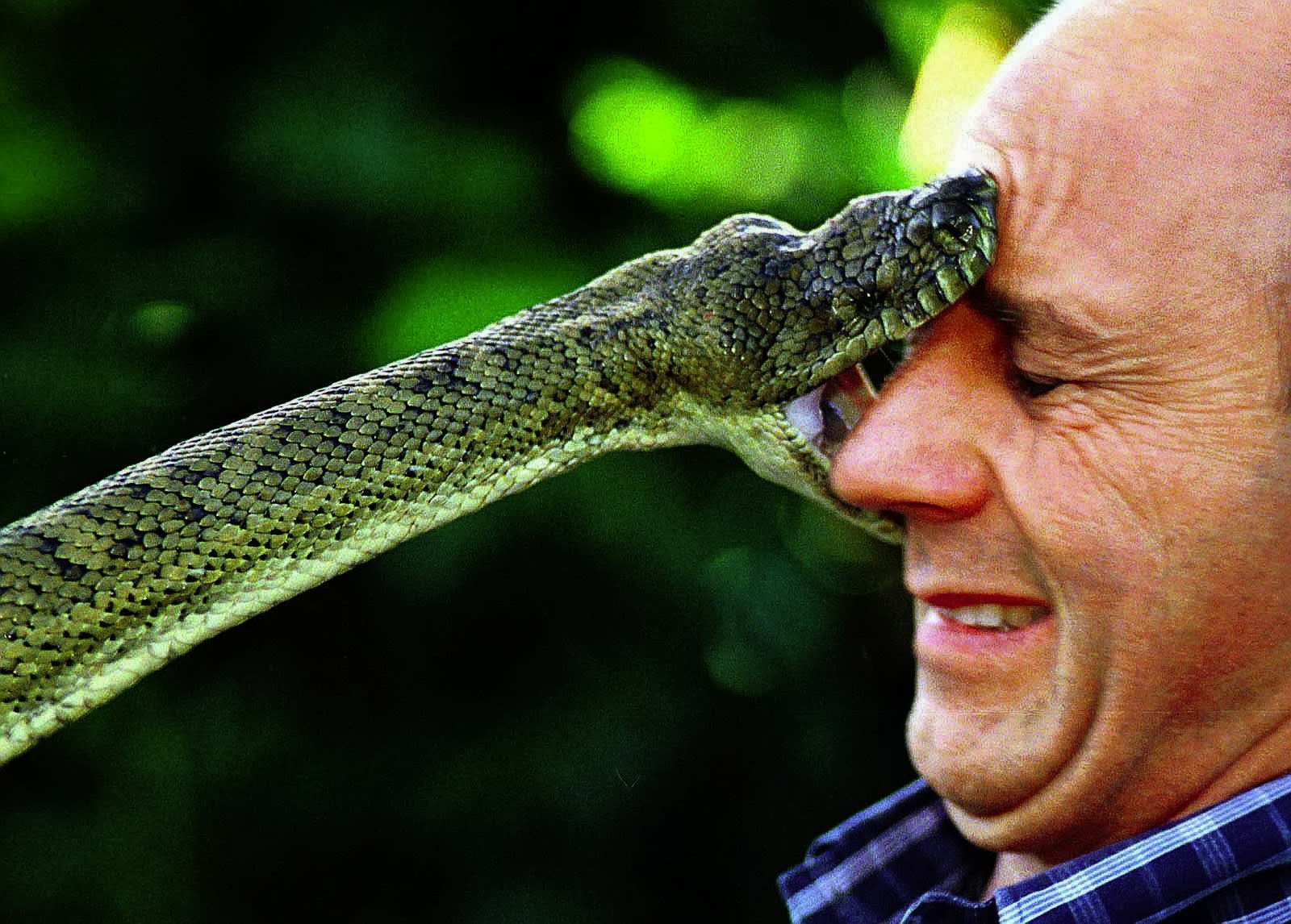 1+a+snake-bite.jpg
