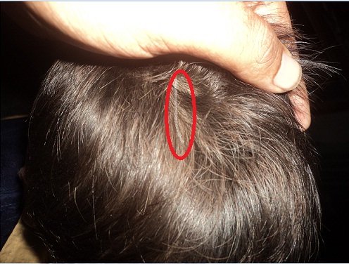 Healthly 3 What Happens When You Remove A White Hair