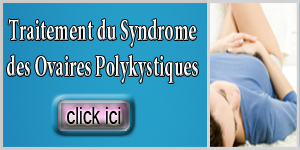 comment traiter le syndrome des ovaires polykystiques