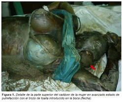 coffin birth