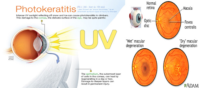 can uv light cause blindness