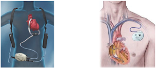 applications of wireless charger medical applications of wireless charger