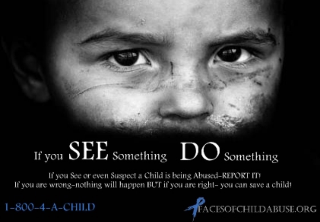 Signs & Symptoms of Child Abuse.
