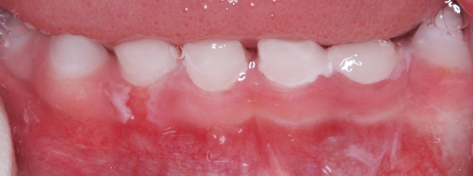 Детская стоматология и ортодонтия в Киеве - блог доктора Пешко Татьяны ...