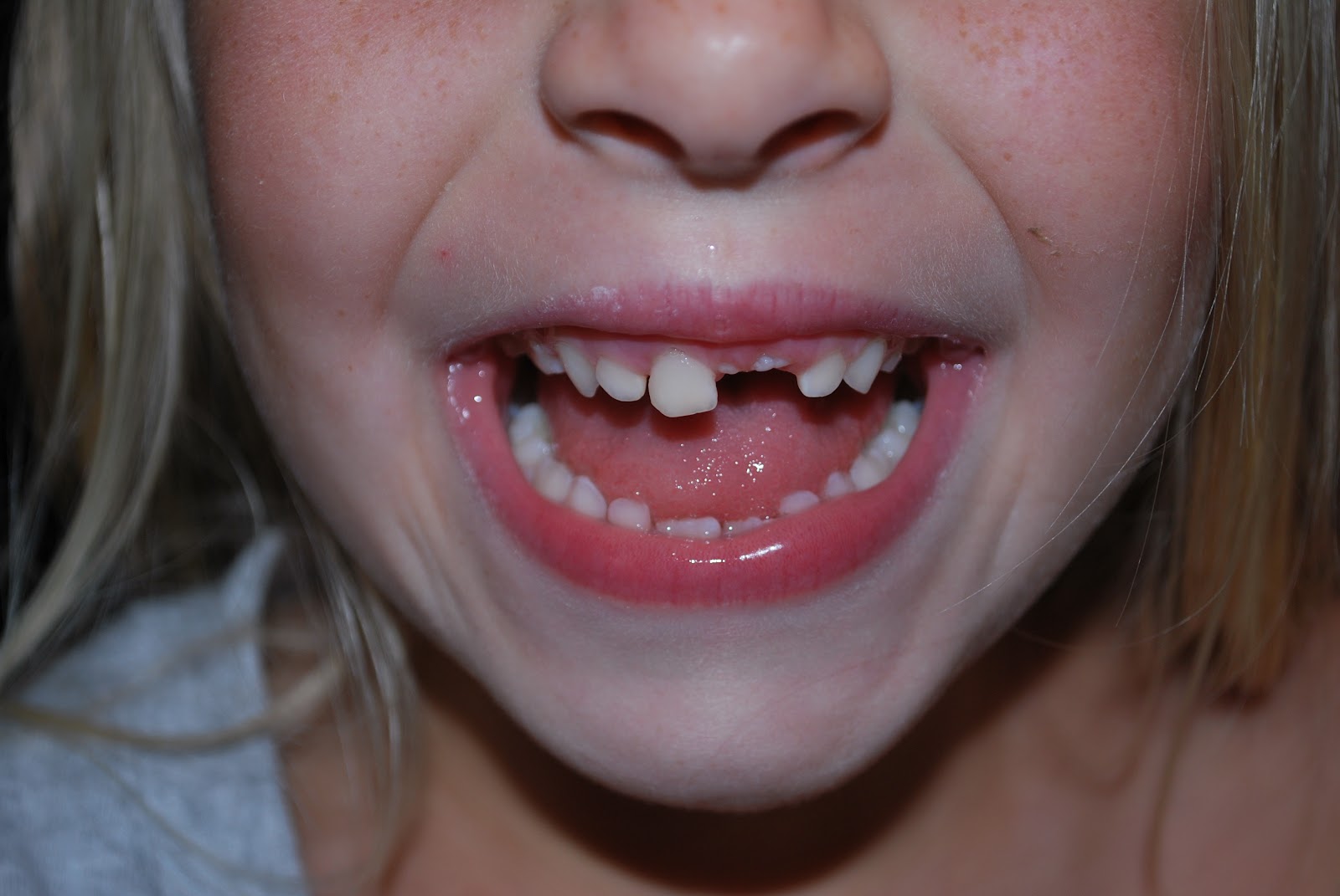 The Warrens Snaggletooth