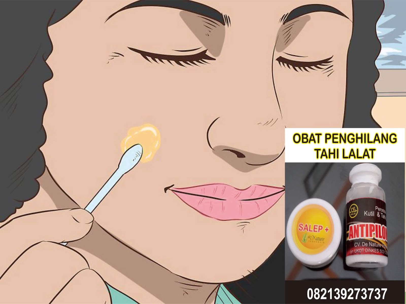 Cara Menghilangkan Bintik Bintik Tahi Lalat Dengan Aman Dan Efektif