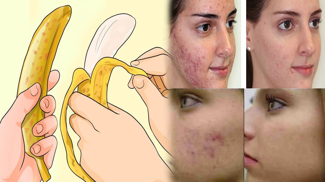 What Happens If You Rub Banana Peel On Your Face? MUST KNOW