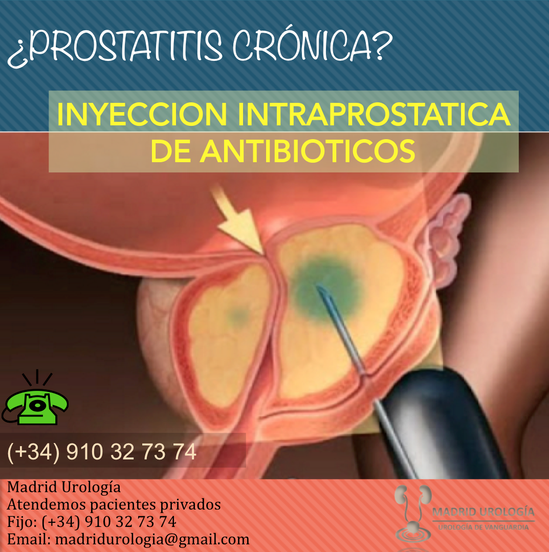 prostatitis crónica e infertilidad prostatitis crónica e infertilidad
