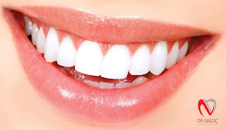Nha khoa uy tín Q10 Dr Ngọc bọc răng sứ Bảo hành 10 năm Nha khoa uy tín Q10 Dr Ngọc bọc răng sứ Bảo hành 10 năm