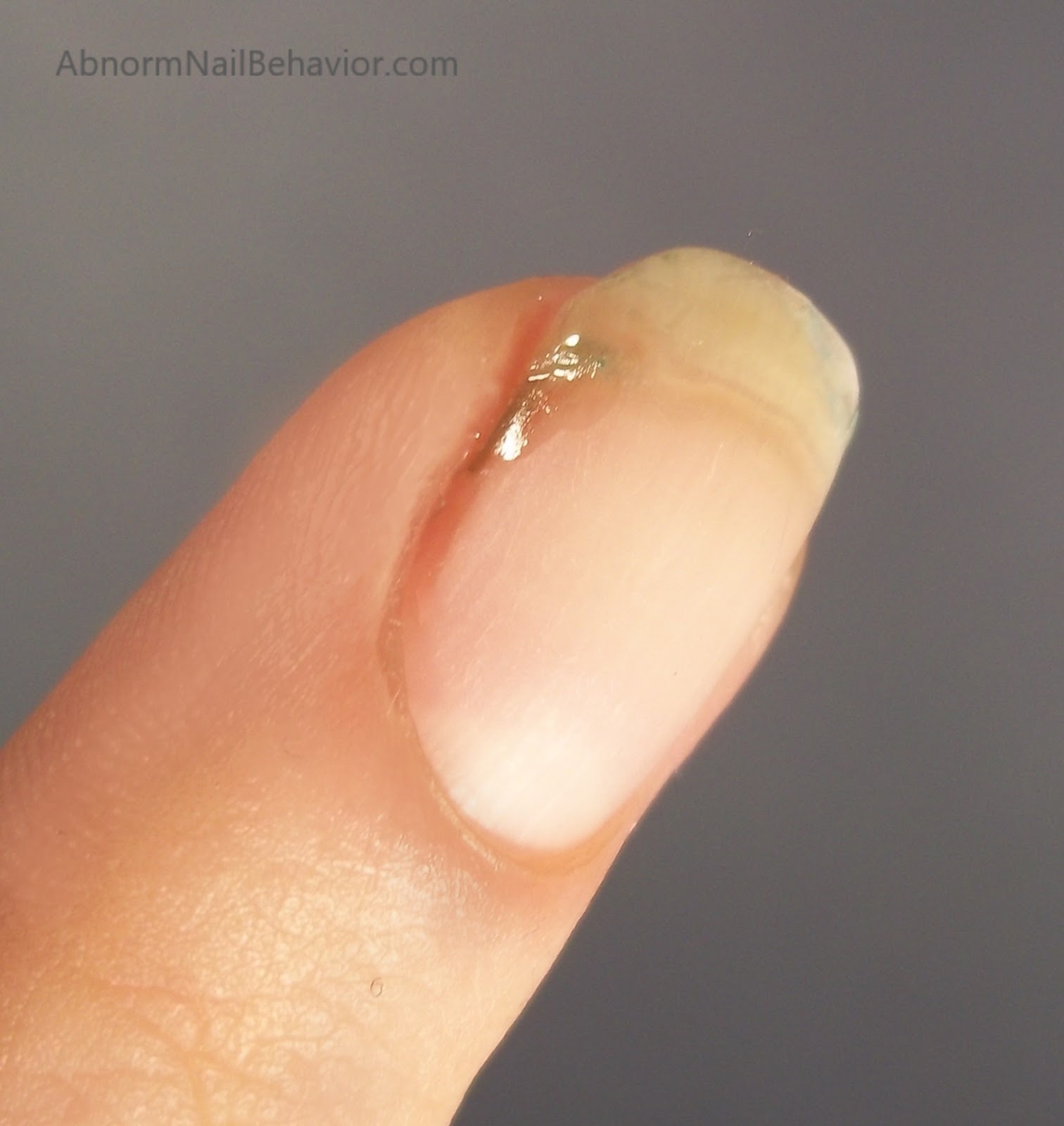 Abnorm Nail Behavior Nail Art How To Repair A Splitting Nail Super