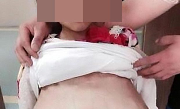A 12-year-old Girl Is Taken To Hospital By A 40-year-old Man. What Doctors Find In His Belly Is Really Shocking