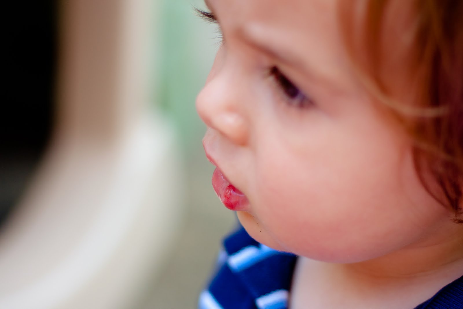 The Edwards Busted Lip