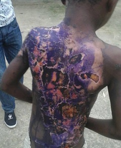 See Crazy Thing Landlord Did To Small Boy In Akwa Ibom State (Pictured)