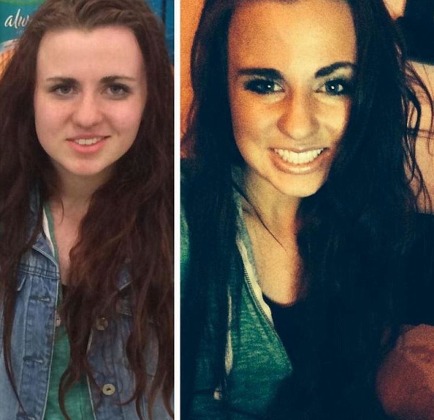Alyssa Gaudinier was only 14 years old when she started using heroin.. - Powerful Before/After Photos Of Women Who QUIT Drugs. Alyssa Gaudinier was only 14 years old when she started using heroin.. - Powerful Before/After Photos Of Women Who QUIT Drugs.