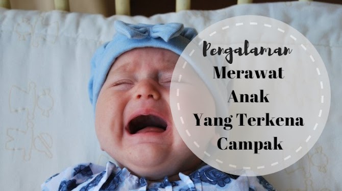 Pengalaman Merawat Anak Yang Terkena Campak