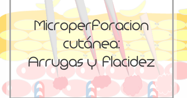 Comprar en la farmacia para la desaparición de las manchas de pigmento