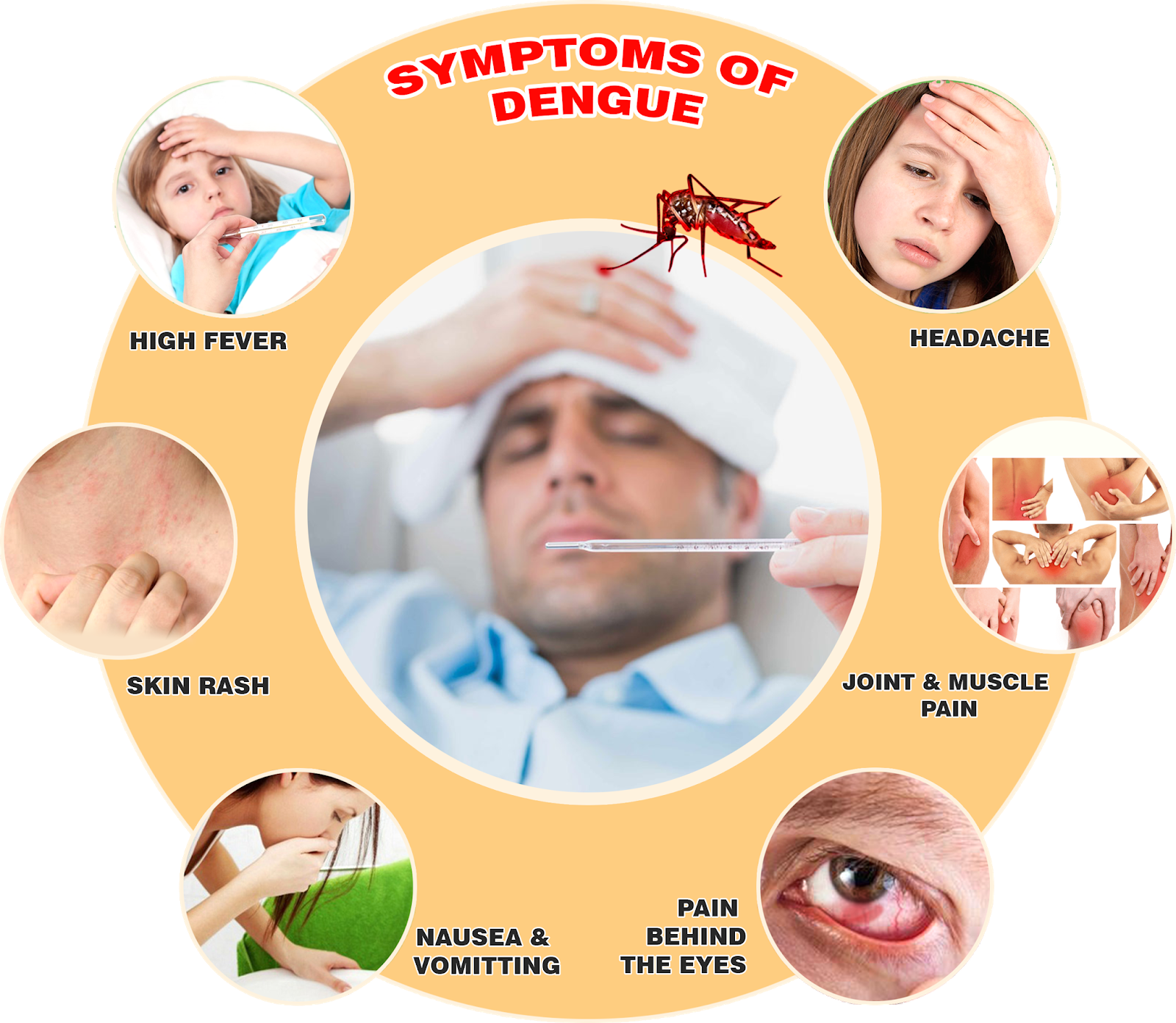 MONSOON DISEASES TREATMENT AND PREVENTION