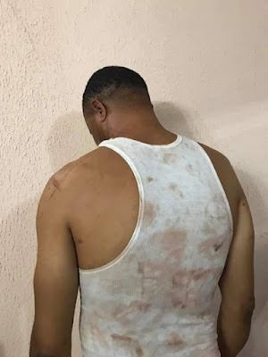 Update: Father of man brutally beaten up for sleeping with policeman
