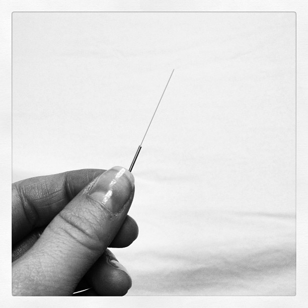 Jade Star Acupuncture: How Big Are The Needles?