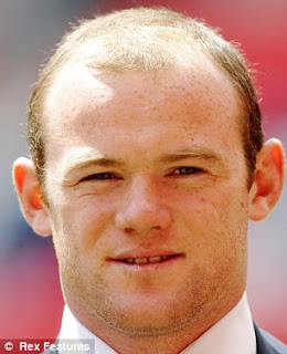 Rooney Going Grey After $30,000 Hair Transplant! 5