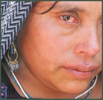 Mujeres (ABEJAS) Acteal, Chiapas