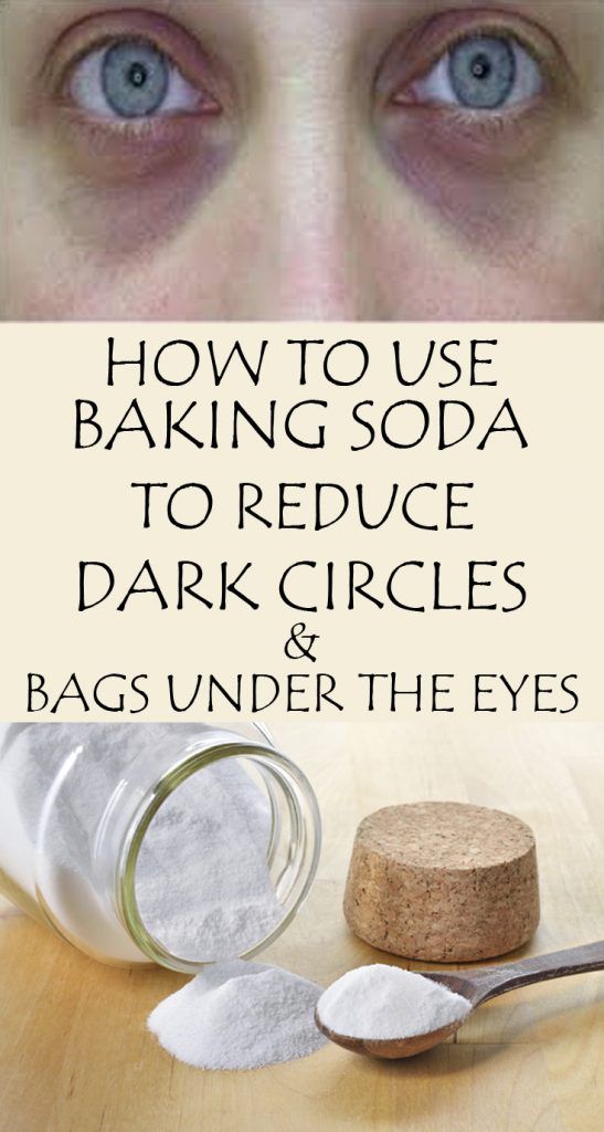 How To Use Baking Soda To Reduce Dark Circles And Bags Under The Eyes HEALTH RECIPES