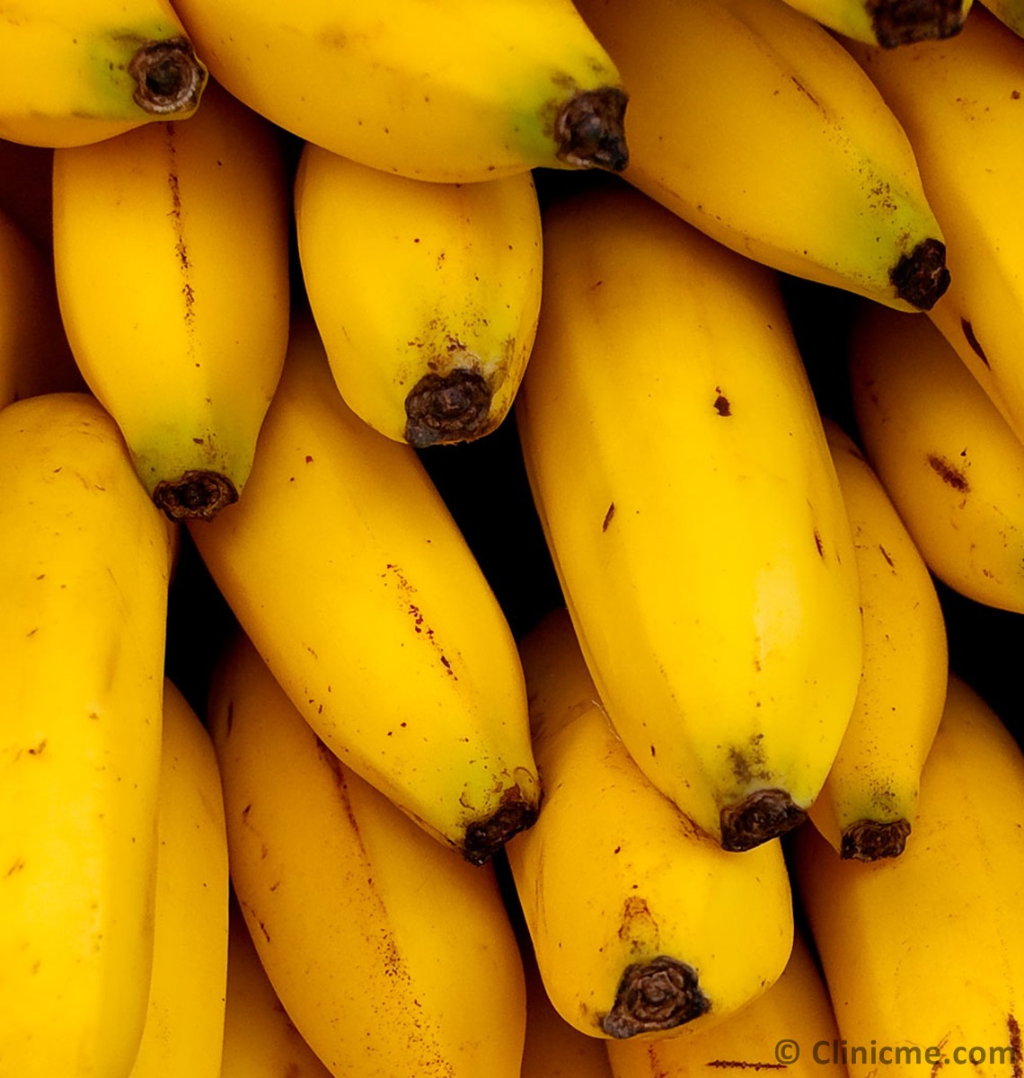 Banana: Health Benefits and Nutrition Facts | Clinicme Banana: Health Benefits and Nutrition Facts | Clinicme