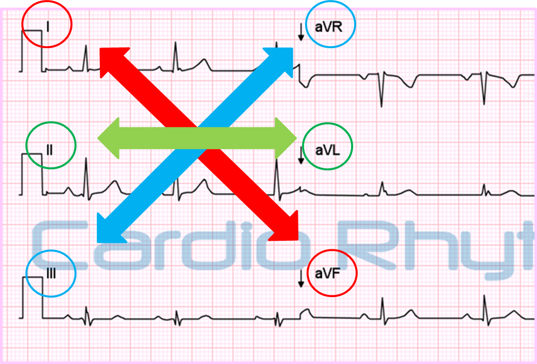 Cardio Rhythms Online Cardiac Axis cardio-rhythms-online-cardiac-axis