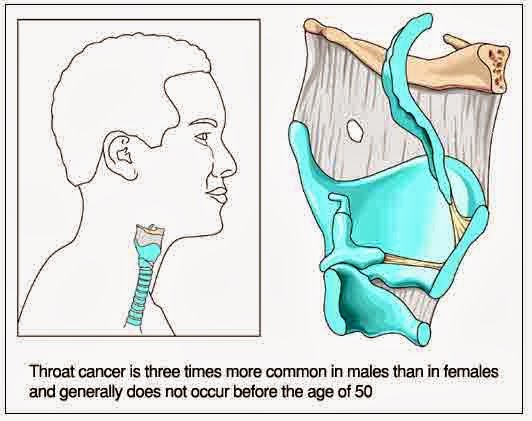 Throat cancer oral sex