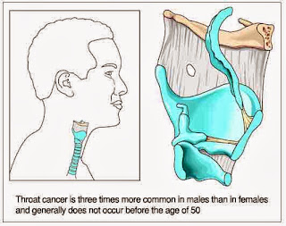 Healthy Life: Can Oral Sex Cause Throat Cancer?