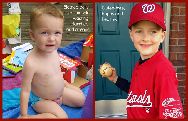 Raising Jack With Celiac Jack s Story raising-jack-with-celiac-jack-s-story