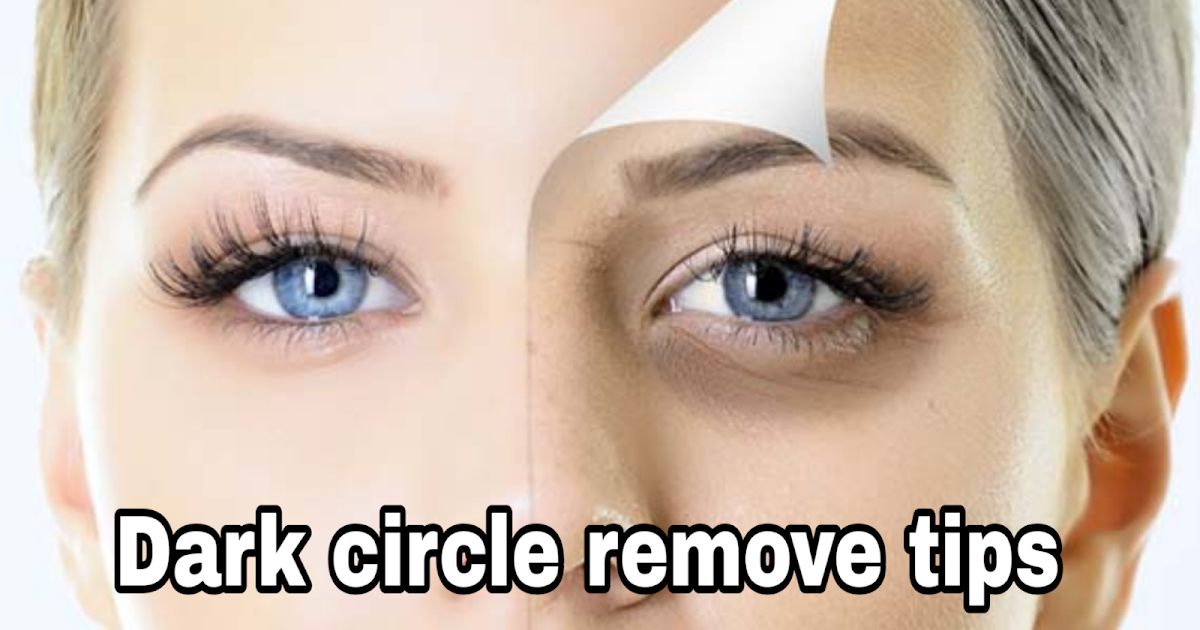 Eyes Dark Circle Remove Tips In Hindi