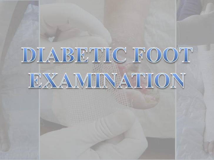Prepare for Medical Exams Diabetic Foot Examination