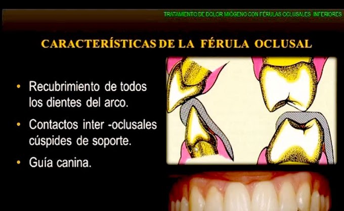 WEBINAR: Férulas de Relajación - Dra. Rosa Amelia Asencios