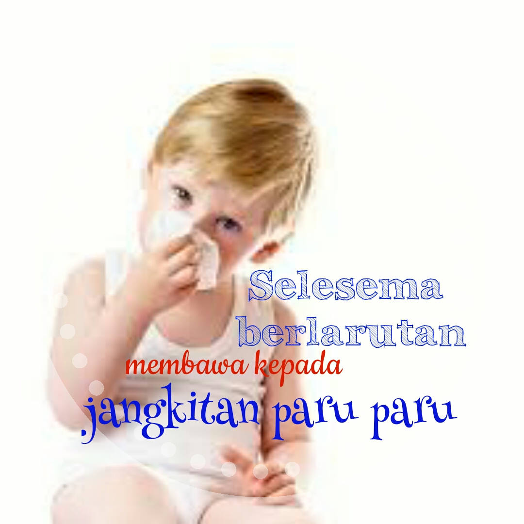 CARA KURANGKAN SELSEMA ANAK - CUTE AND BEAUTY