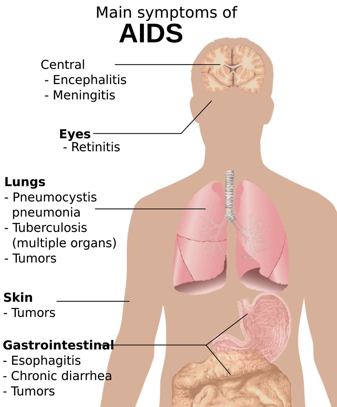 How do i find out if i have hiv