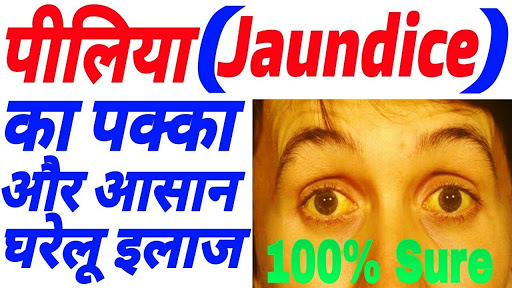 पीलिया रोग का आयुर्वेदिक इलाज, Jaundice Treatment in hindi पीलिया रोग का आयुर्वेदिक इलाज, Jaundice Treatment in hindi