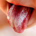 Candidiasis of the Mouth, Throat and Oesophagus