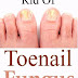 How To Get Rid Of Fungal Skin Infections