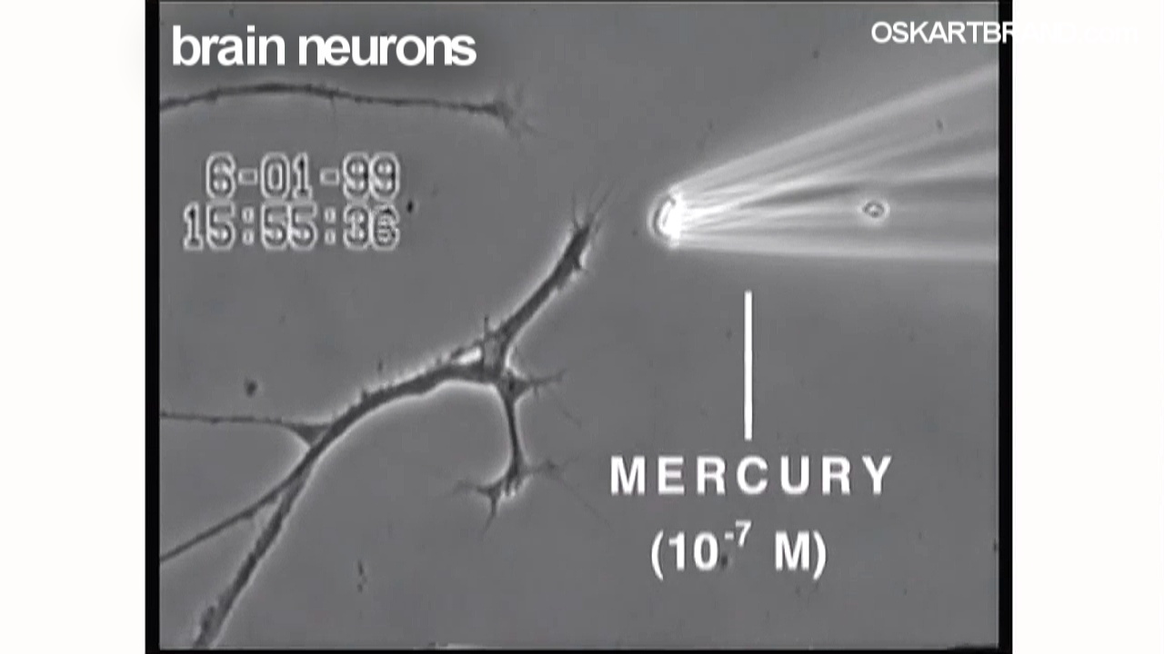 Oskar T. Brand Amalgam Truth Smoking Teeth And Mercury Toxicity