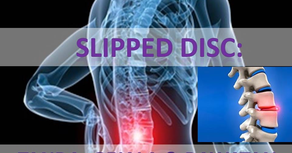 3D health beauty supplement CAKERA TERGELINCIR SLIPPED DISC APA