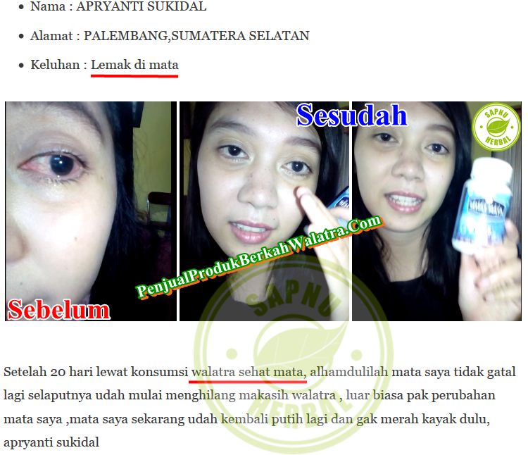 Cara Mengobati Mata Merah dan Pandangan Kabur yang Terbukti Mujarab ~ TESTIMONI SEHAT MATA SOFTGEL Cara Mengobati Mata Merah dan Pandangan Kabur yang Terbukti Mujarab ~ TESTIMONI SEHAT MATA SOFTGEL