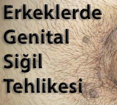 Hpv Nedir Nasil Bulasir Kansere Yol Acar Mi Dr Baris Korkmaz