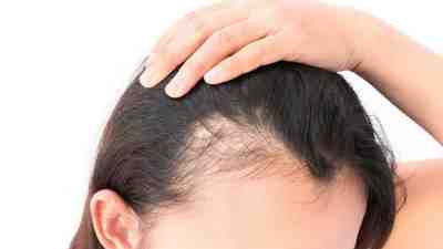 وصفة لمنع تساقط الشعر مجربة