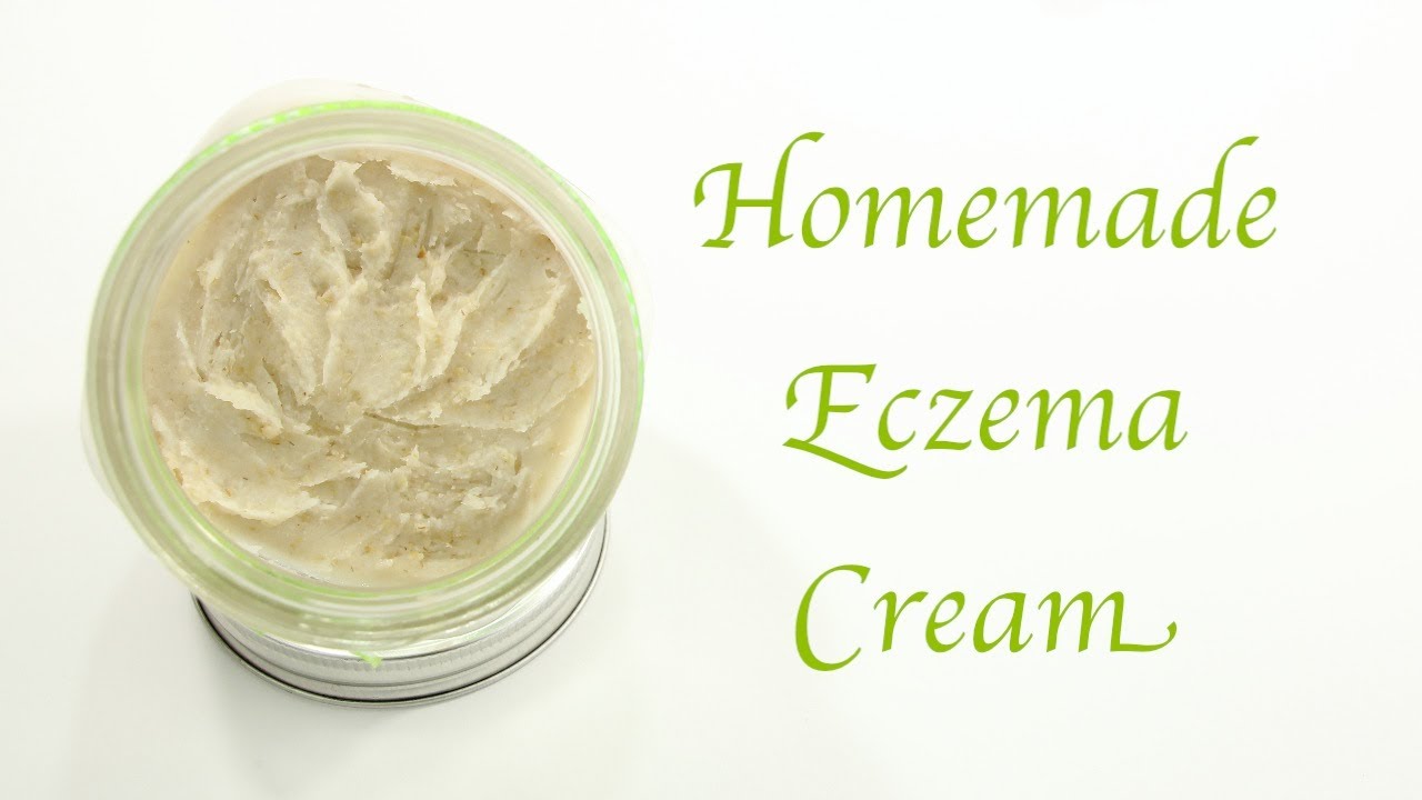 Eczema Creams A Solution For Your Dry Rashes